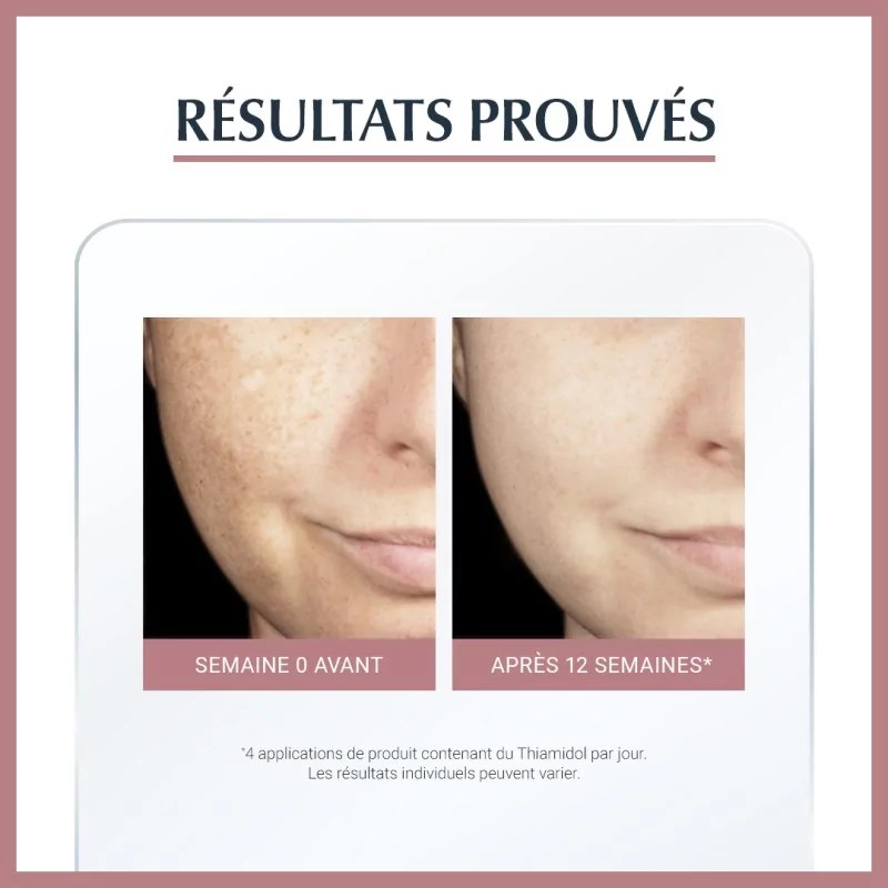 EUCERIN EUCERIN Anti-pigment Serum-Eclat 30ml — vue 4